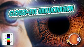 Closed eye hallucination  Your EYEBALLS  EYNTK 👁️👁️💉😳💊🔊💯✅ [upl. by Ridglee710]