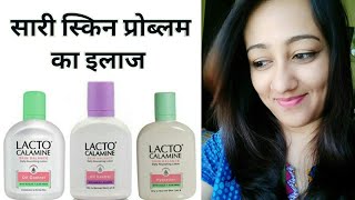 LACTO CALAMINE LOTION REVIEW IN HINDI FOR OILY amp DRY SKIN HOW TO APPLYUSE BENEFITS [upl. by Nalyac]