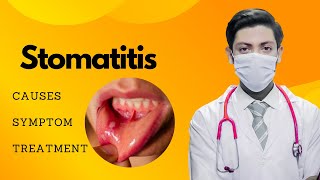 quotStomatitis Symptoms Causes and Treatment  Comprehensive Guide for Oral Healthquot [upl. by Anelrats]