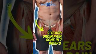 2 Years of Groin Pain gone in 7 weeks [upl. by Oderf]