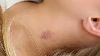 how to make a fake hickey on your neck with makeup fast [upl. by Waylan977]