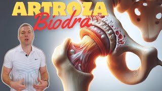 pokonaj swoje ZWYRODNIENIA BIODRA  trzask w biodrze endoproteza [upl. by Abner153]