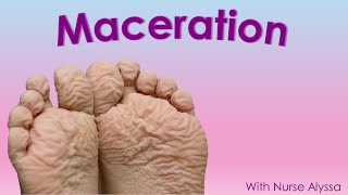 Understanding Wound Maceration [upl. by Aseek]