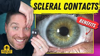 The Amazing Benefits Of Scleral Contact Lenses [upl. by Romilly]