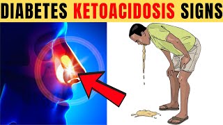 8 Fatal Diabetic Ketoacidosis Symptoms Most Diabetics Ignore [upl. by Eicaj]