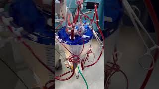 Cardiac perfusionist shorts perfusion heart hospital mbbs ott doctor shorts trending live [upl. by Flessel162]