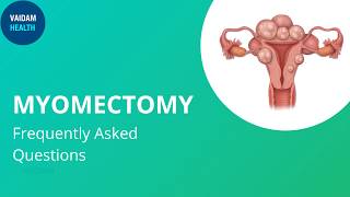 Myomectomy Frequently Asked Questions [upl. by Nosydam]