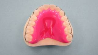 FINAL ORTHODONTIC RETAINERS AFTER BRACES OR INVISALIGN [upl. by Greenman]