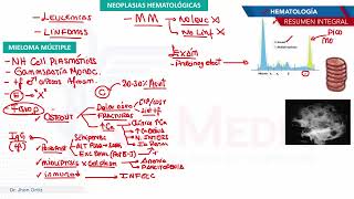 Hematología  Neoplasias mieloma multiple [upl. by Mauer]