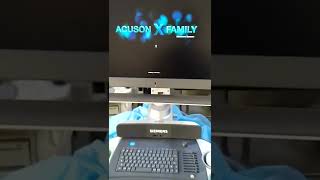 Siemens Acuson X700 Ultrasound [upl. by Nahgam938]