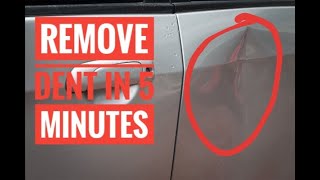 Remove dent on car in 5 minutes  chandra vlogs [upl. by Victorine]