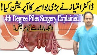 Operation of 4th Degree Piles  Haemorrhoidectomy of very big Piles  Surgeon Dr Imtiaz Hussain [upl. by Initirb]