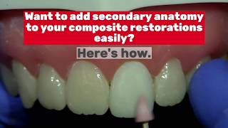 Composite Veneer Characterization Made Easy by Cosmedent [upl. by Jase]