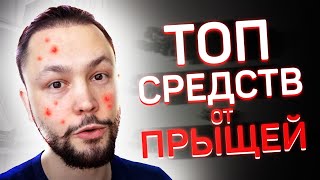 ТОП средств для лечени акне [upl. by Cicenia]