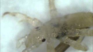 Watch a lice louse hatch under a microscope [upl. by Krucik575]