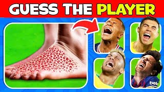 Who Got INJURY 😭🩸Football QuizComparison INJURY Moments of Football Player Messi Ronaldo [upl. by Ellenij287]