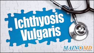 Ichthyosis Vulgaris ¦ Treatment and Symptoms [upl. by Jerald]