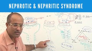 Nephrotic and Nephritic Syndrome  Causes Symptoms amp Treatment🩺 [upl. by Nesaj176]