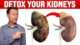 A Surprising Way to Cleanse Toxic Kidneys  Dr Berg on Kidney Detoxification [upl. by Airotahs]