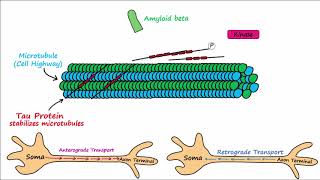 Alzheimers Disease  plaques tangles pathogenesis risk factors disease progression [upl. by Ohara]