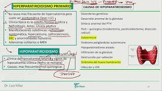 Endocrinología  Hipertiroidismo primario [upl. by Campos]