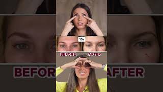 HOW TO REMOVE UNDEREYE BAGS LINK IN BIO [upl. by Josefa]