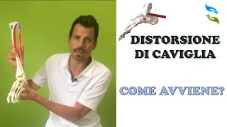 Distorsione di caviglia come avviene cosa aspettarsi [upl. by Daberath]