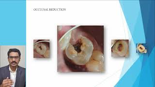 INFODONTICS  S01 E07  Endodontics simplified  Cleaning and Shaping  Introduction [upl. by Eednil]