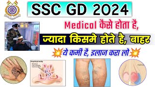 SSC GD 2024 Medical Test Details  SSC GD Medical Me kya kya hota hai ssc gd medical kaise hota hai [upl. by Pedrick988]