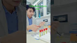 Viral marker test HCV HIV HBsAG VDRL bloodtestkaisehotahai bloodtest [upl. by Haidabo]