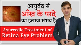 Ayurvedic Treatment for Retina Eye Problems  आयुर्वेद से आँख के परदे का इलाज संभव है [upl. by Johann]