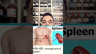 Enlargement of spleenSplenomegalyhomeopathyshortsDr Deepak singh prayagraj [upl. by Merrielle]