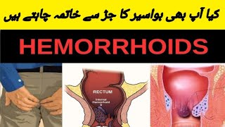 How To Get Rid Hemorrhoid [upl. by Dewie]