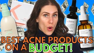 Best Acne Products Under 35 Dollars [upl. by Itak]