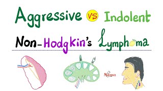 NonHodgkins Lymphoma  Aggressive type VS Indolent type  Hematology and Oncology [upl. by Senga]