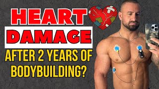 Heart Damage After 2 Years Of Bodybuilding HEAVY Leg Day [upl. by Reahard201]