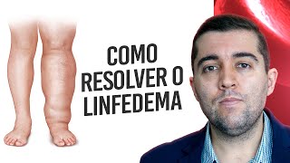 Linfedema má circulação nos linfáticos que causa inchaço e dor nas pernas Como resolver [upl. by Htebezile]