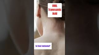 tranexamic acid ORAL for melasma treatment shorts [upl. by Ellehcear756]