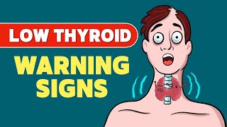 Signs that you have a Low Thyroid Level  Hypothyroidism  Signs amp Symptoms  Thyroid disease [upl. by Hashimoto]