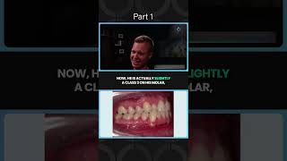 🦷 Transforming Smiles Addressing Bolton discrepancies amp tackling aesthetic concerns PART I [upl. by Chadbourne]