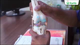 Life After Anterior Cruciate Ligament ACL Surgery  Dr Atul Mishra Fortis Hospital Noida [upl. by Doxia]