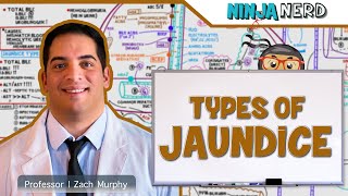 Gastrointestinal  Types of Jaundice [upl. by Ijar]