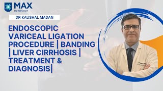 Endoscopic Variceal Ligation Procedure Banding Liver Cirrhosis Treatment amp Diagnosis Dr Kaushal [upl. by Ydnes]