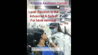 Do you know moles occur due to human Papilloma Virus  Contact your Doctor soonmoleremoval [upl. by Ahsinac985]