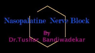 Nasopalatine Nerve Block made easy [upl. by Aryn]