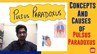 Pulsus Paradoxus mechanism amp causes inicet neetpg hindi [upl. by Nwahsyd]