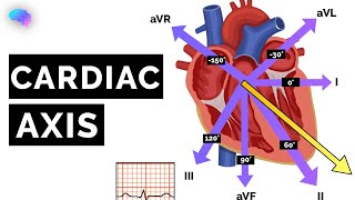 Cardiac Axis Explained  ECG  EKG  OSCE Guide  UKMLA  CPSA [upl. by Eelir]