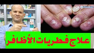 علاج فطريات الاظافر onychomycosis [upl. by Nirik]