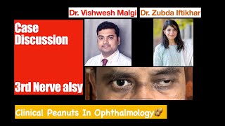 case Discussion  Oculomotor Third Nerve Palsy [upl. by Primrosa504]