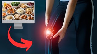 Best And Worst Foods For Arthritis Pain  What To Eat [upl. by Eeralih]